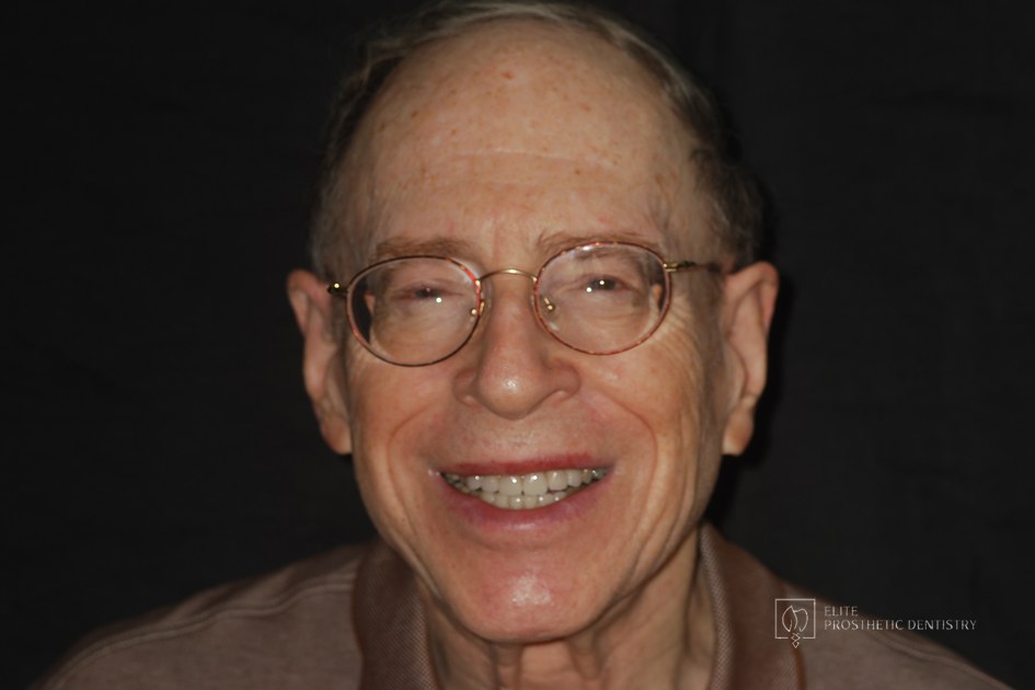 After: Repairing the Worn Out Dentition: How Severely Worn Teeth Were Rebuilt for Long-Term Function
