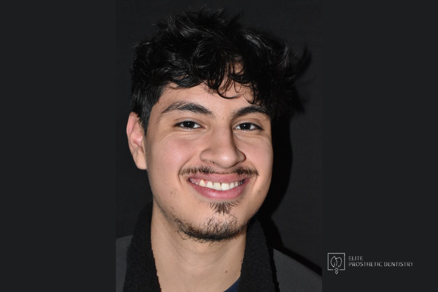 The completed result in a natural full-face view.