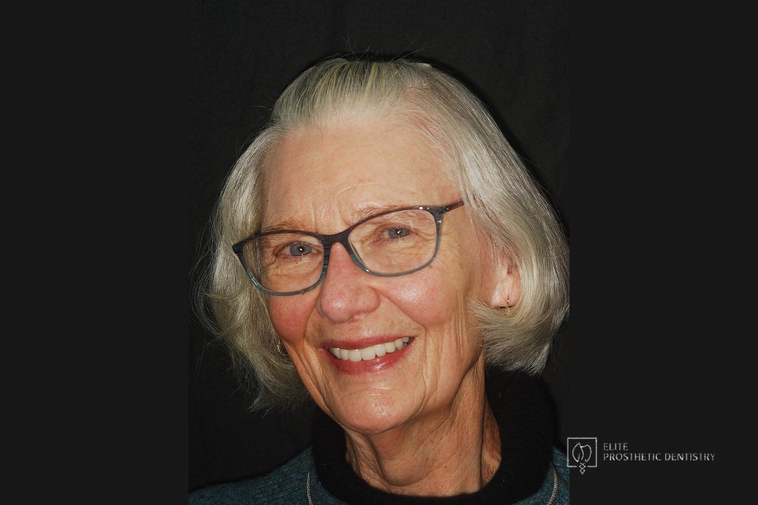 The completed result in a natural full-face view.